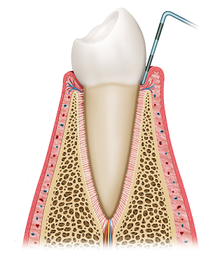 건강한 잇몸 이미지
