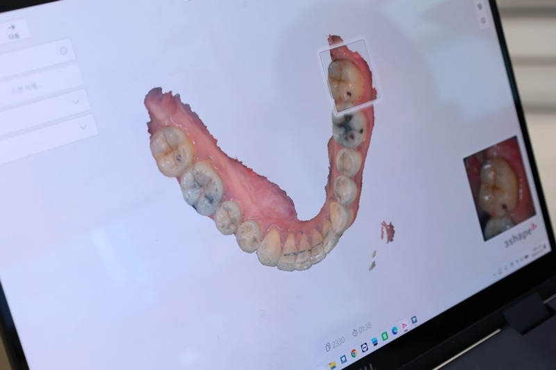서울하늘에치과 제1회 3D 구강스캔 대회 개최3.JPG